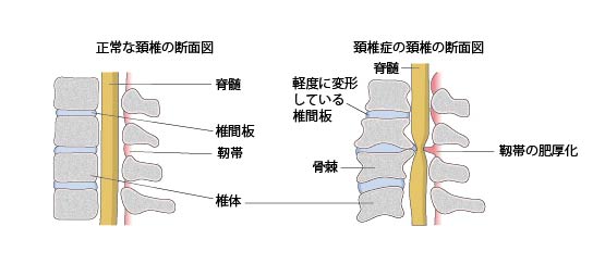 脊椎の断面図